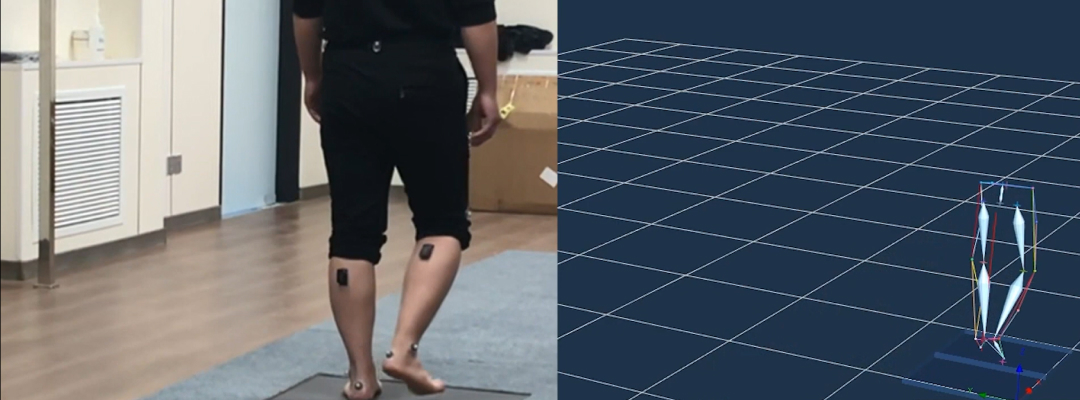 リハビリの画像